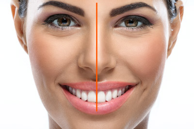 Trattamento di medicina estetica integrata al sorriso a Roma Quadraro, zona Tuscolana e Cinecittà