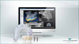 Implantologia dentale a Roma Quadraro presso lo Studio Dentistico Santaniello