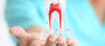 Devitalizzazione e cura dei denti con tecniche conservative a Roma Quadraro