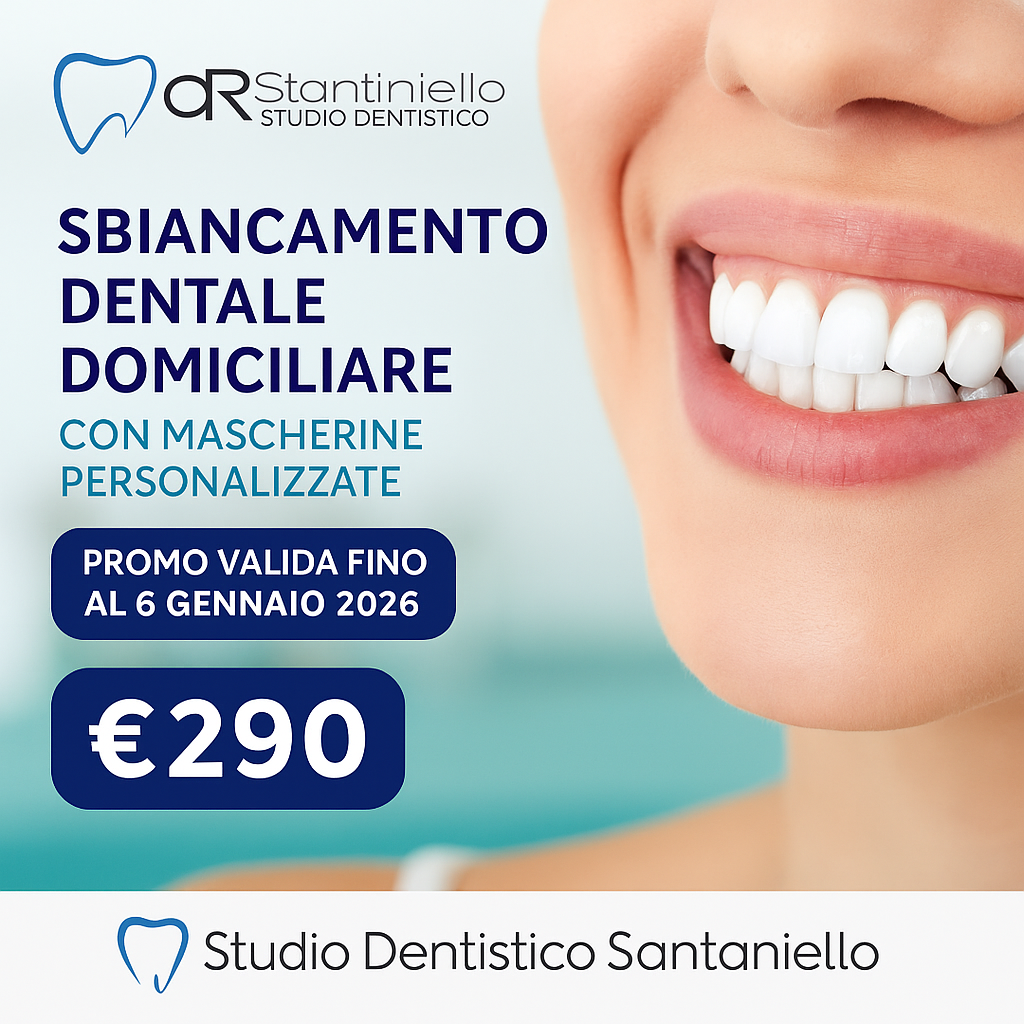 Offerta sbiancamento dentale domiciliare con mascherine – Studio Dentistico Santaniello Roma Quadraro